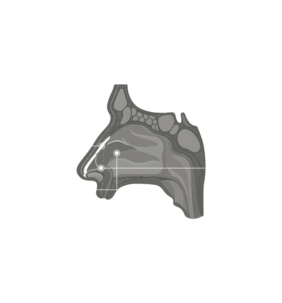 Anatomía nasal con líneas de referencia