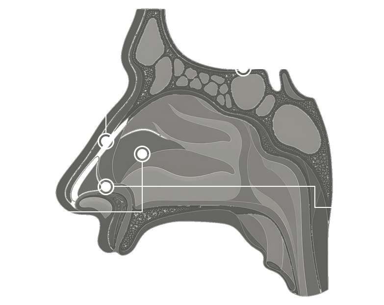 Anatomía nasal con líneas de referencia